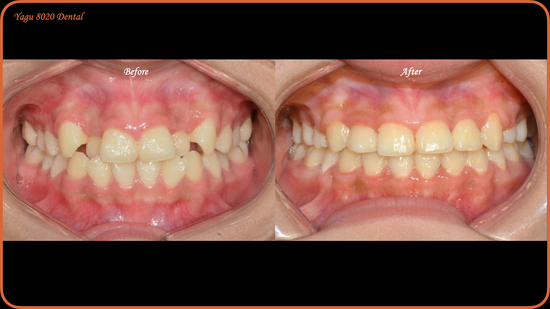 case thumbnail 4