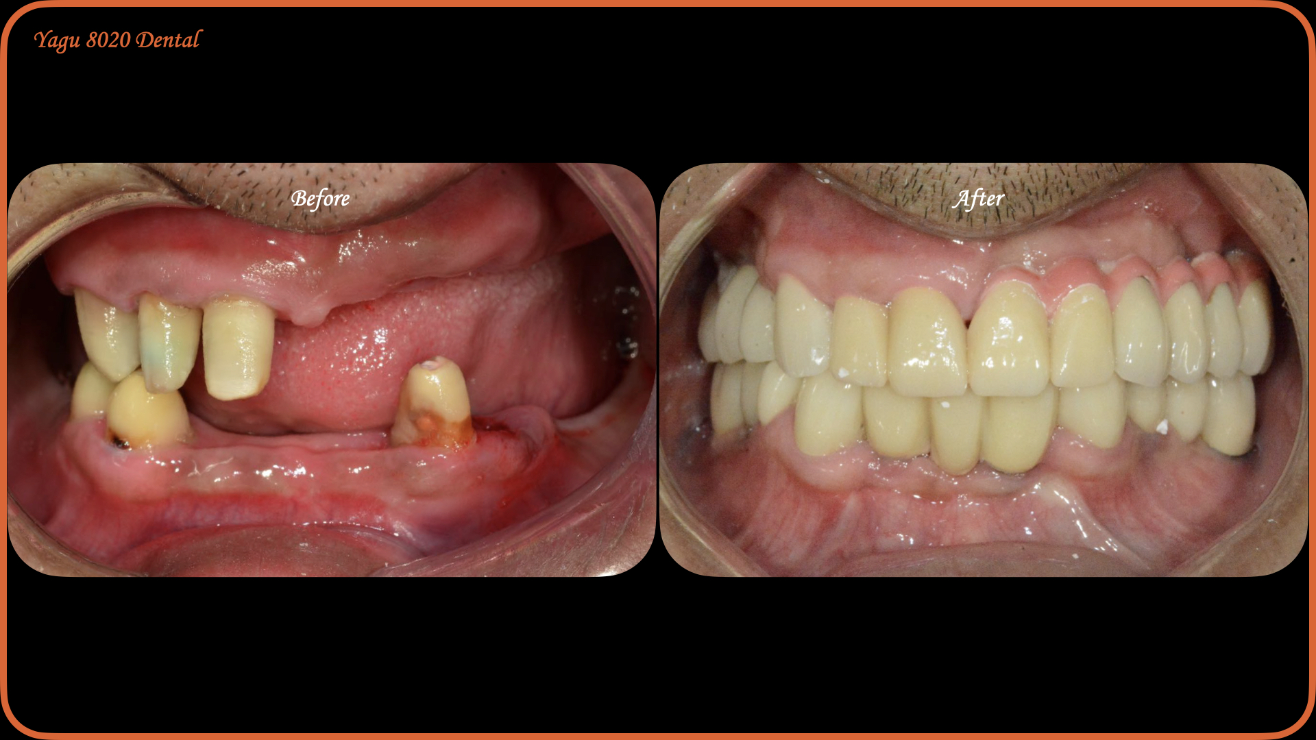 case thumbnail 5