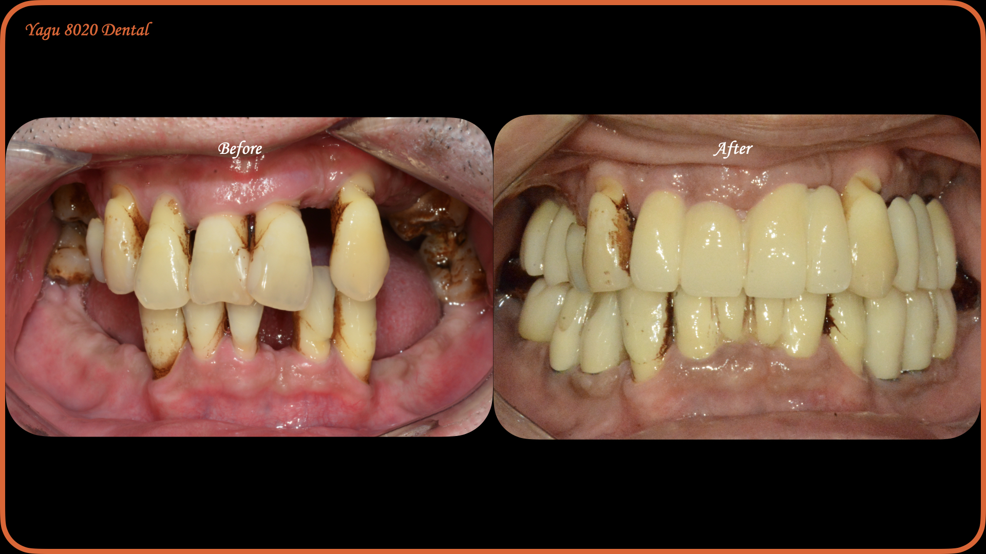 case thumbnail 6