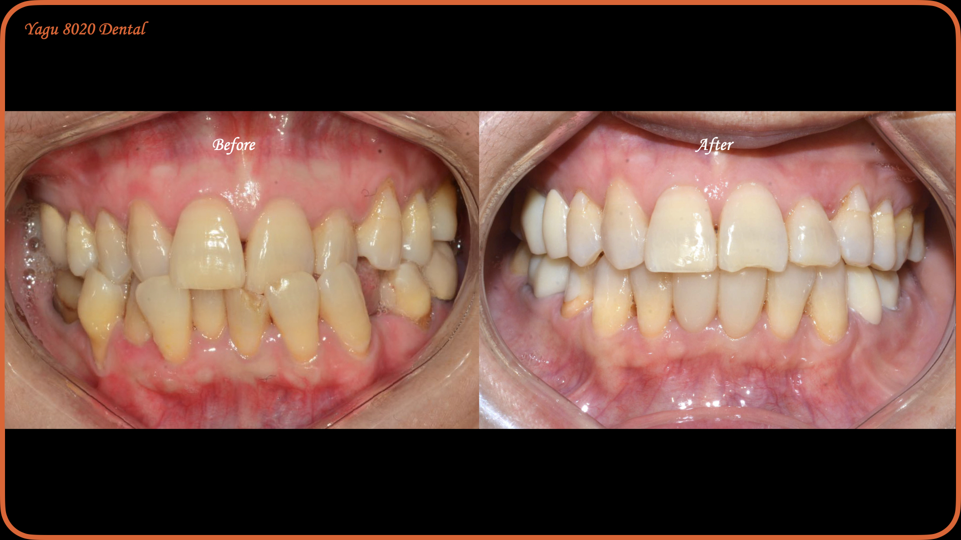 case thumbnail 2